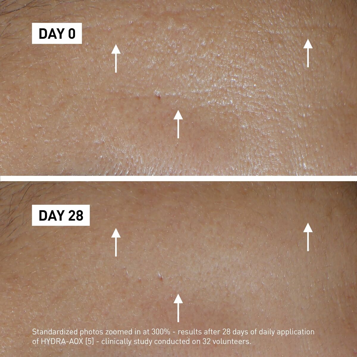 Cremă de Zi Filorga Aox