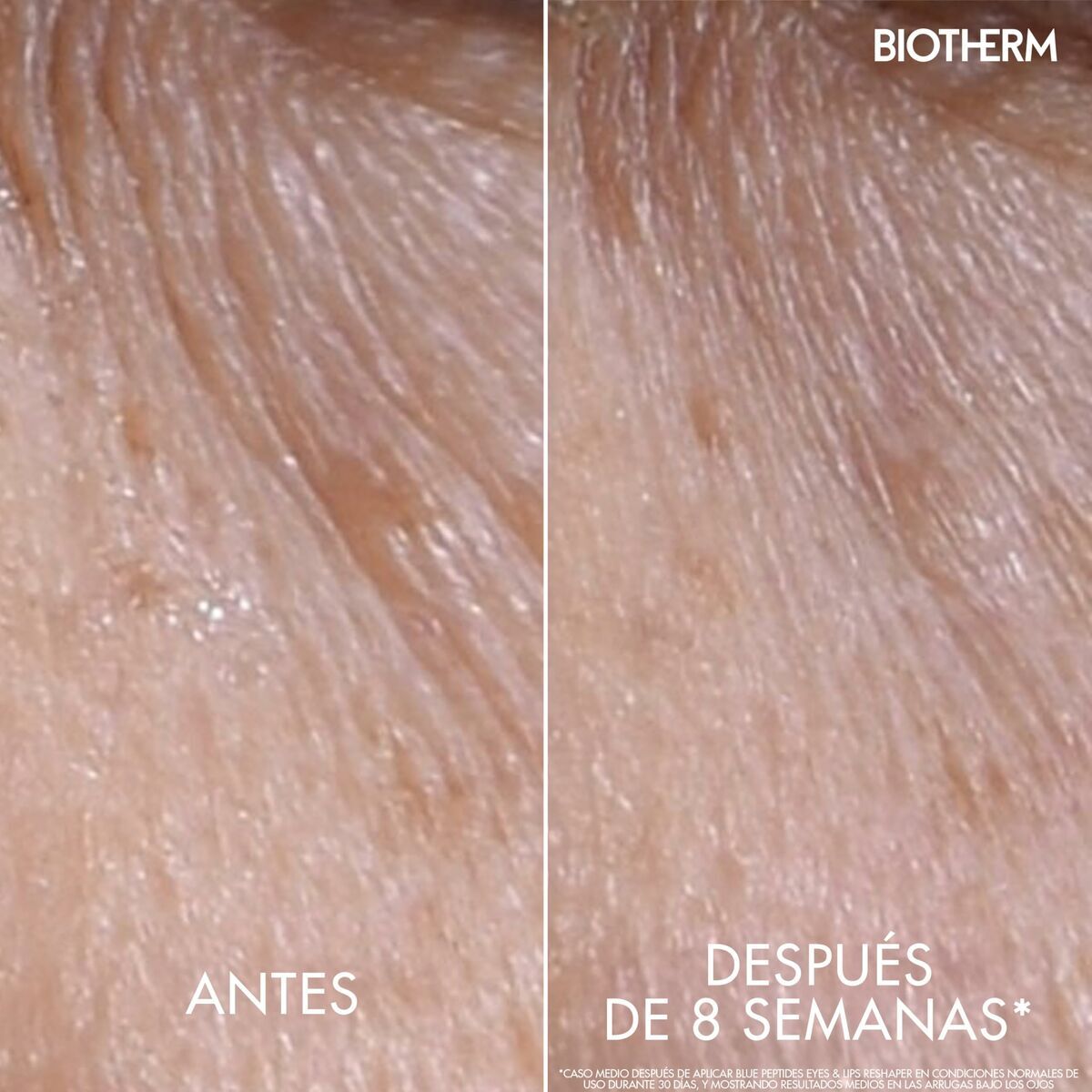Contur de Ochi Biotherm BLUE PEPTIDES 15 ml