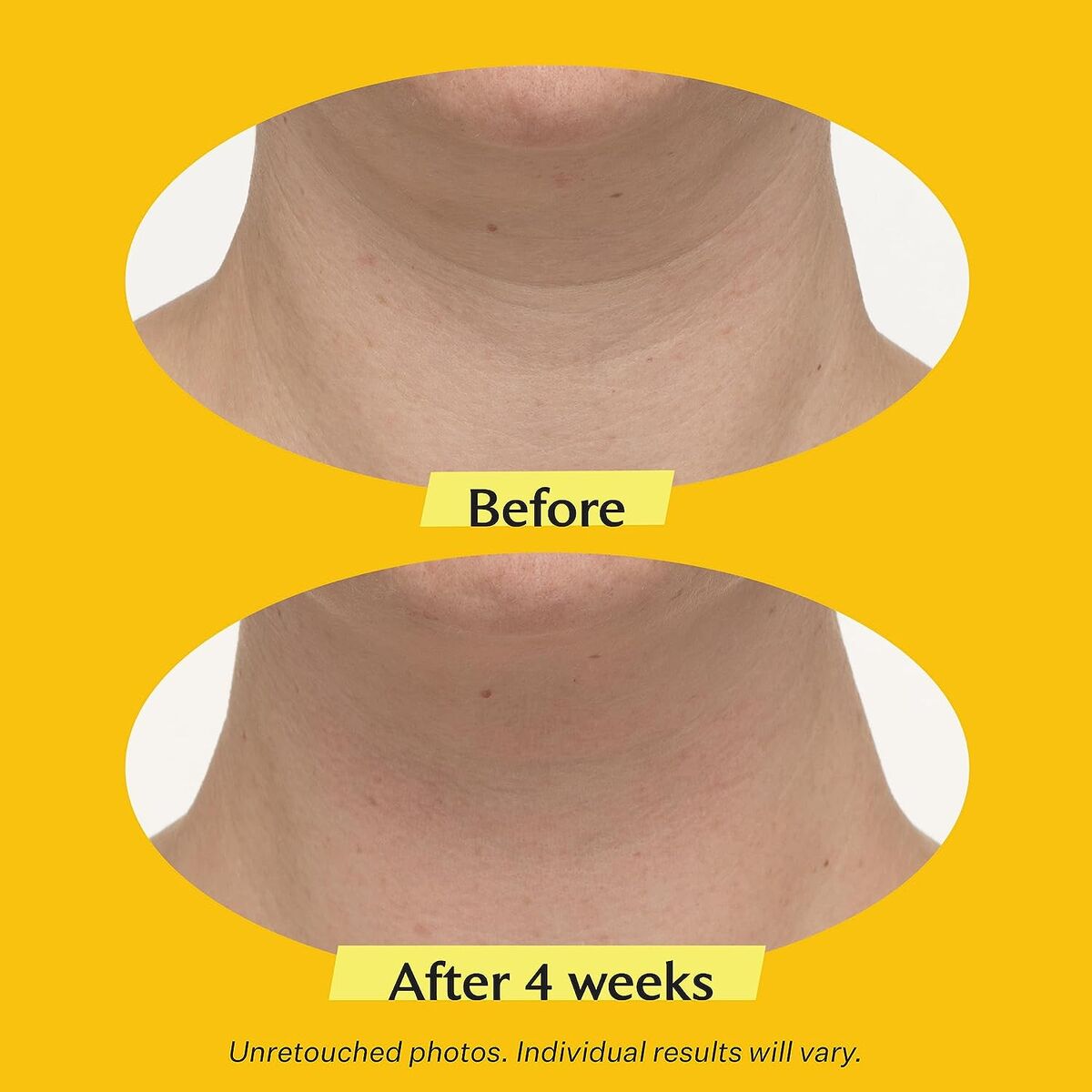 Cremă de Față StriVectin Tl Advanced Tightening 50 ml